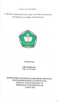 Gambaran Formalin Pada Tahu Yang Dijual Di Pasar Tradisional Flamboyan Pontianak / Wibisono, Aris.-- Pontianak : PoltekkesKemenkes Pontianak JurusanAnalis Kesehatan, 2017.- 47 p