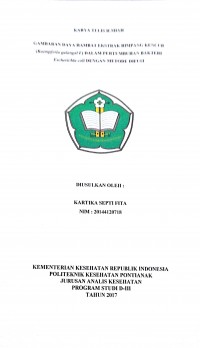 Gambaran Daya Hambat Ekstrak Rimpang Kencur (Kaempferia galangal L) Dalam Pertumbuhan Bakteri Escherichia coli Dengan Metode Difusi / Fita, Kartika Septi.-- Pontianak : PoltekkesKemenkes Pontianak JurusanAnalis Kesehatan, 2017.- 44 p