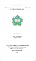 Gambaran Identifikasi Jamur Malassezia furfur Pada Anak-Anak Di panti Asuhan Al-Amien / Halida, Wigilysta.-- Pontianak : PoltekkesKemenkes Pontianak JurusanAnalis Kesehatan, 2017.- 31p