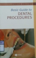 BASIC GUIDE TO DENTAL PROCEDURES