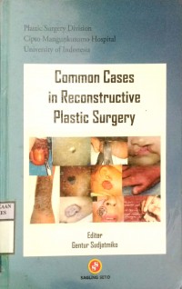 COMMON CASES IN RECONSTRUCTIVE PLASTIC SURGERY