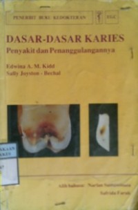 DASAR-DASAR KARIES : Penyakit dan Penanggulangannya (Essentials of Dental Caries) : The Disease and its management