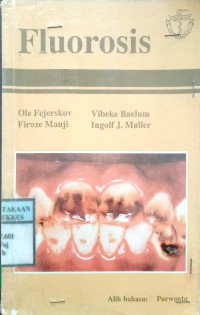 FLUOROSIS