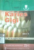 KARIES GIGI     Edisi 2