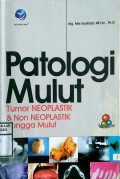 PATOLOGI MULUT : Tumor Neoplastik & Non Neoplastik Rongga Mulut