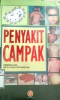 PENYAKIT CAMPAK