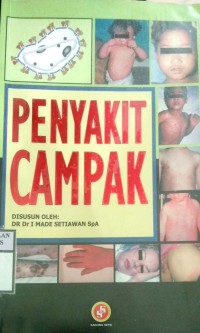 PENYAKIT CAMPAK