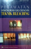 PERAWATAN DISKOLORASI GIGI DENGAN TEKNIK BLEACHING