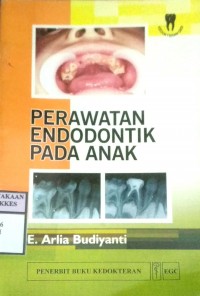 PERAWATAN ENDODONTIK PADA ANAK