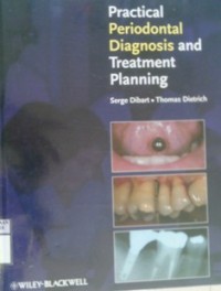 PRATICAL PERIODONTAL DIAGNOSIS AND TREATMENT PLANNING