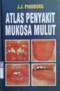 ATLAS PENYAKIT MUKOSA MULUT